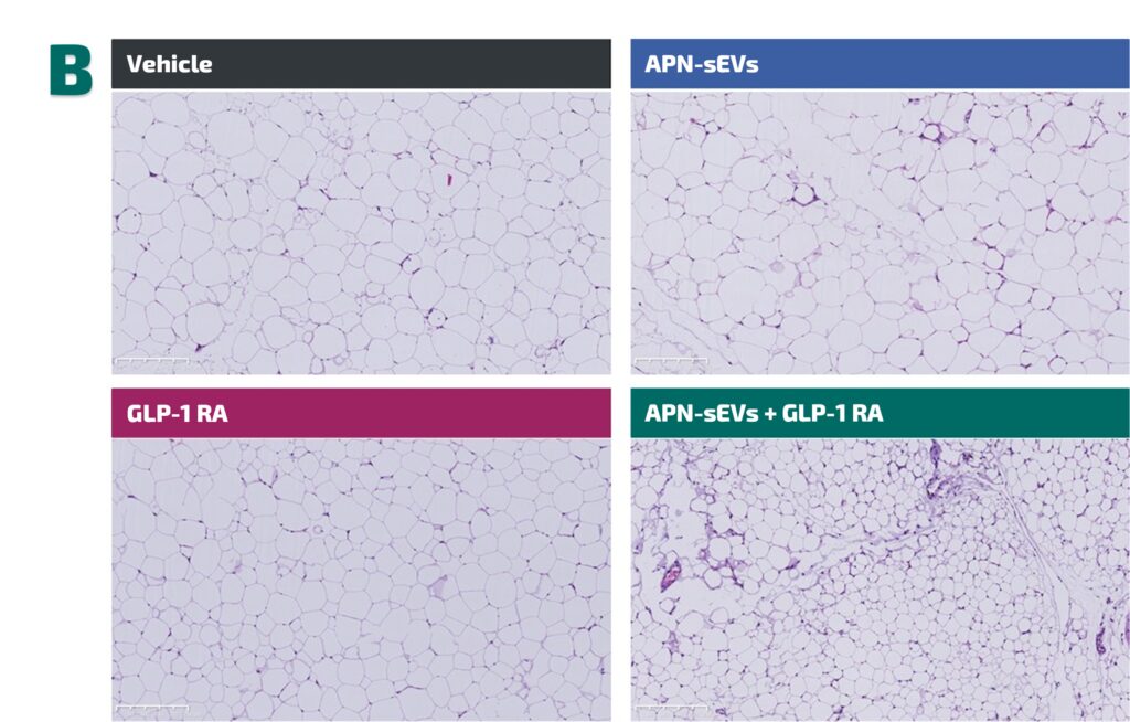 Adipocyte
